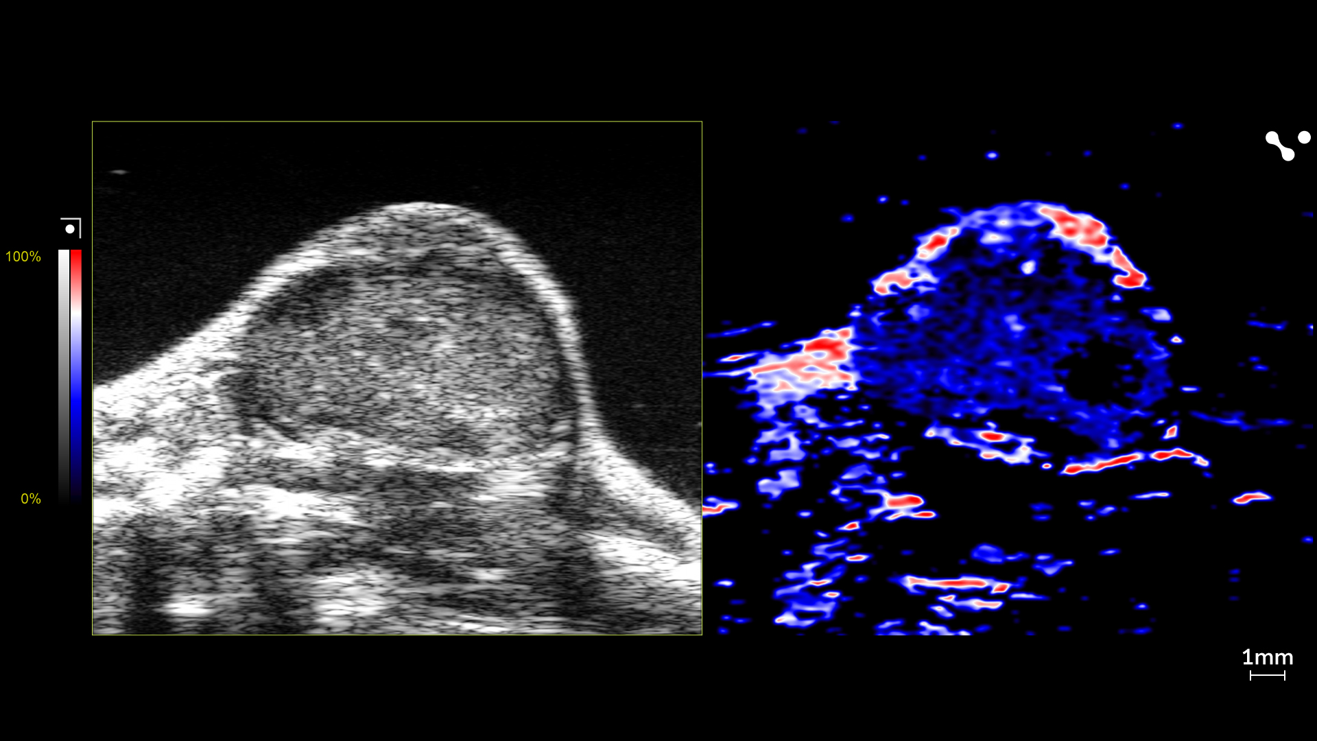 Oxy-hemo image of a mouse tumor showing shear wave elastography, scanned using a UHF29x transducer. 