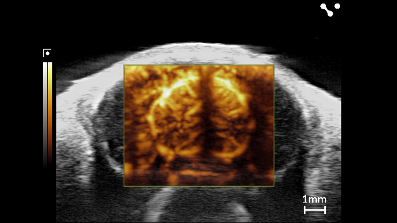 Ultrafast Doppler Mode (UFD) showing the mouse brain transcranial with bubbles