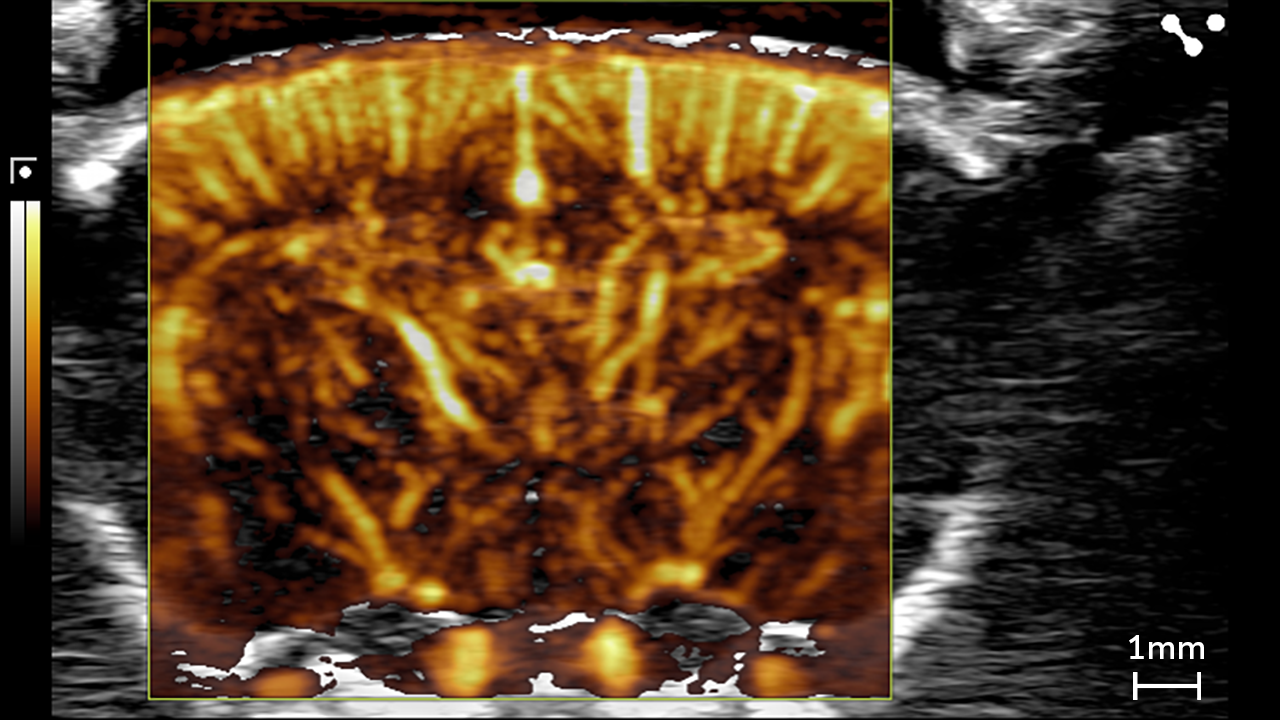 Ultrafast Doppler Mode (UFD) showing the rat brain cranial window
