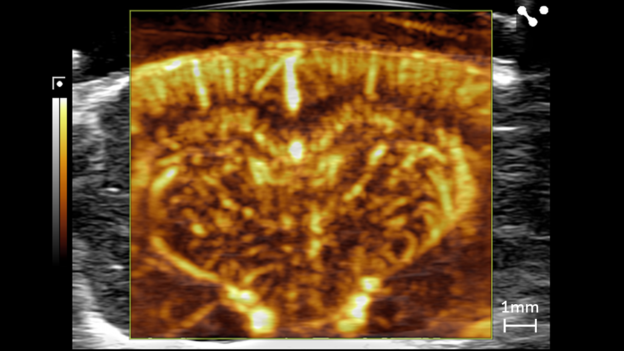 Ultrafast Doppler Mode (UFD) showing the rat brain cranial window