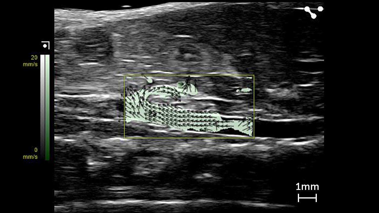 Vector Flow Imaging showing the mouse abdominal aorta.
