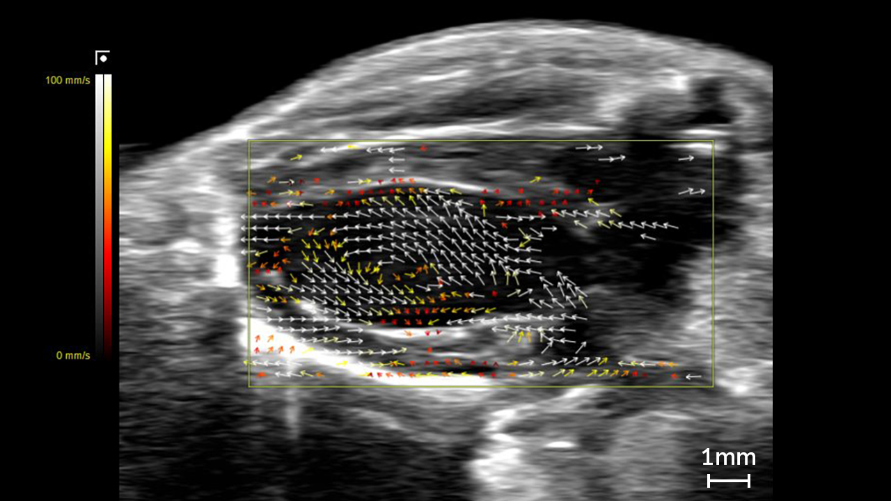 Vector flow imaging in a mouse heart, shown in a yellow box