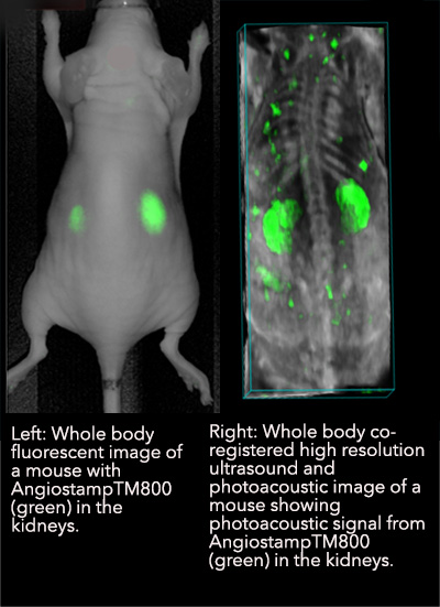Flourescent vs PA contrast agent.jpg