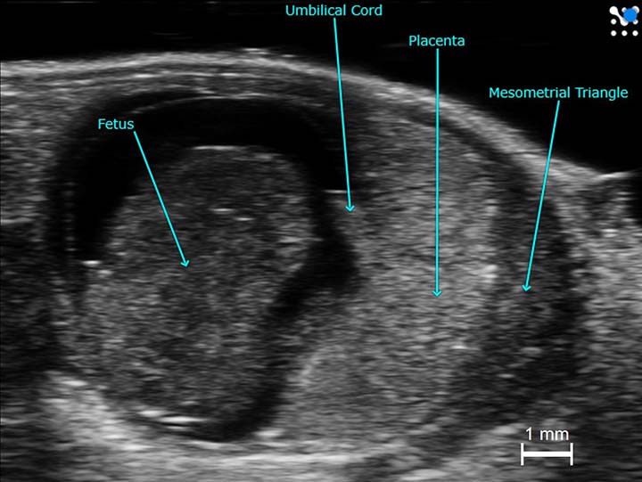  BASIC US SHORT NOES Mid-Gestational%20Mouse%20Implantation%20Site_0