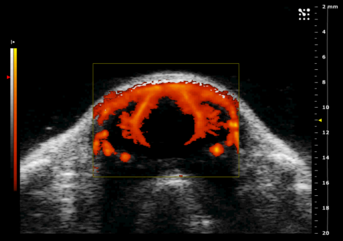 PowerDoppler_USPIO_PBCA_MB_Brain.jpg