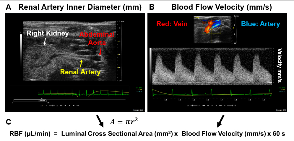 Renal Blood Flow.jpg