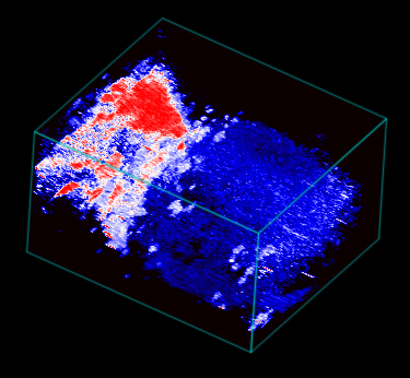 rHL-ischemia-oxyhemo-3D.jpg