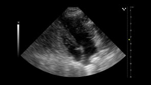 Apical heart in small dog P10