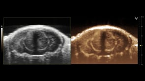 Brain Vasculature Visualized using Contrast Microbubbles