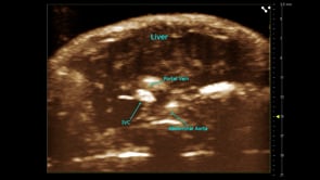 Mouse Liver NLC MIP