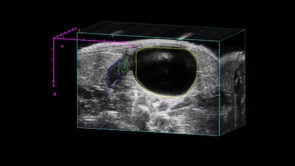 Uterus, Cervix and Bladder in the Mouse