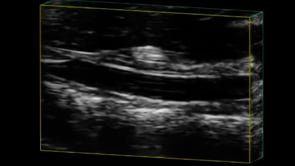 Abdominal Aorta in 4D