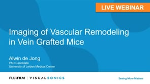 September 2021: Imaging of Vascular Remodeling in Vein Grafted Mice