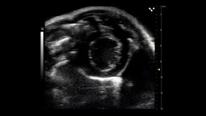 Short axis image of the mouse heart