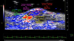 Parametric Map of Oxygen Saturation in Orthotopic Breast Tumor Model