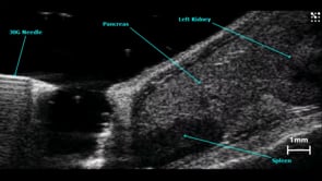 Injection into the Mouse Pancreas