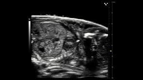 Late gestational fetal heart and liver in a mouse