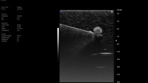Vevo MD UHF 48 Phantom with needle insertion