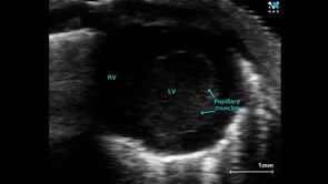 4D Image of the Mouse Left Ventricle (Parasternal Long Axis)