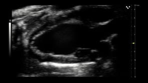 Parasternal long axis in a mouse