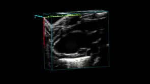 4D image of the mouse heart