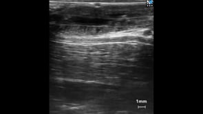 Intestinal Cilia in the Rabbit