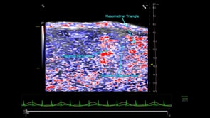 Placental Oxygen Saturation