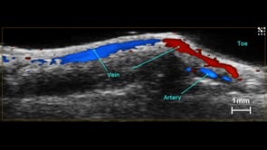 Vasculature in the Mouse Paw