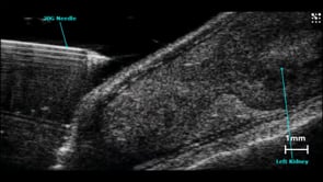 Injection into the Renal Cortex