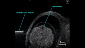 Mouse embryonic spinal cord injection