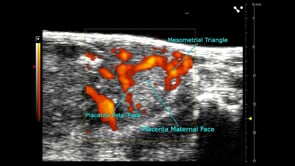 Mid-gestational Mouse Placenta