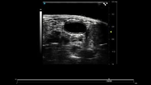 UHF57x - Mouse Bladder