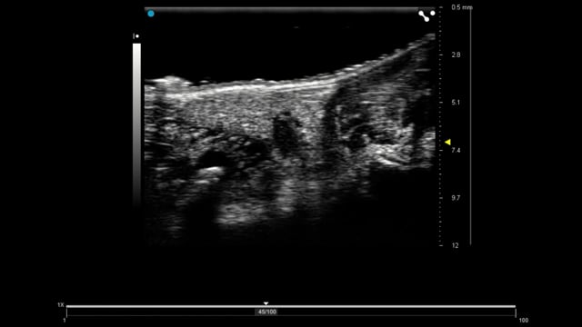 UHF57x - Mouse Axillary Lymph Node