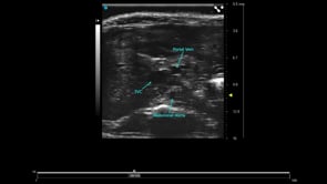 UHF57x - Mouse Liver
