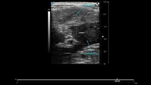 UHF29x - Rat Fatty Liver
