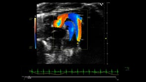 Color Doppler of Mouse Aortic Arch