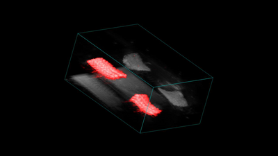 3D render of overlaid ultrasound and photoacoustic signal from 2 labelled and 2 control hernia meshes.