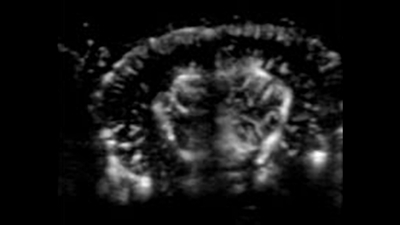 Black and white image of Ultrafast Doppler Mode (UFD) showing the mouse brain transcranial