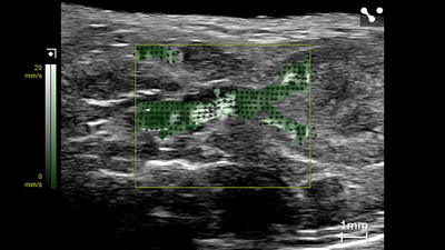 Vector flow imaging in the mouse kidney highlighted in green with black arrows.
