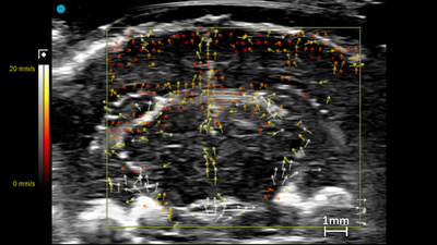 Vector flow imaging showing the cranial window of a rat brain.