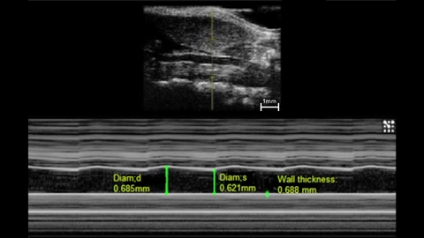 M-Mode of a Mouse Carotid Artery