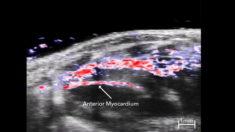PA EKV image of blood oxygen saturation levels in the mouse heart during systole
