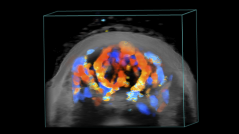 3D Color Doppler of Mouse Brain