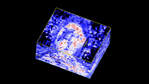 3d image of mouse brain in PA Oxyhemo Mode