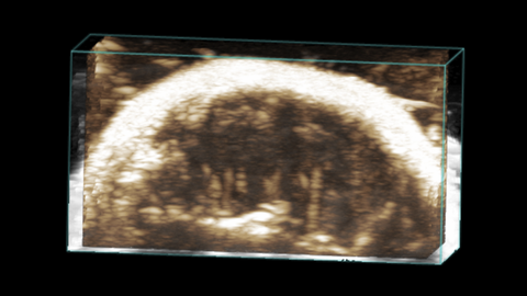 3D image of mouse brain in NLC mode
