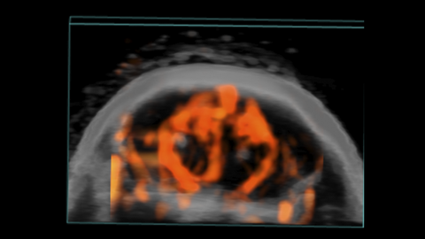 3D image of mouse brain in Power Doppler mode