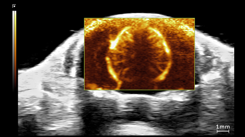 Ultrafast Doppler image of mouse brain in 1.5 month old CD-1 mouse