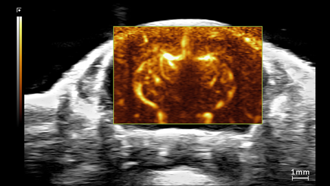 Ultrafast Doppler image of mouse brain of a 1.5 month old CD-1 mouse