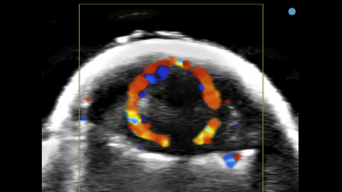Color Doppler image of mouse brain