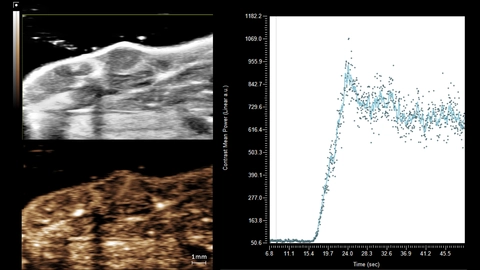 Maximum intensity projection (MIP) of MicroMarker wash-in acquired in NLC mode. Contrast region graph shows quantification of the tumor ROI.